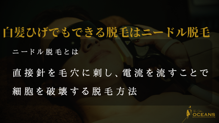 白髪ひげでもできる脱毛はニードル脱毛とは