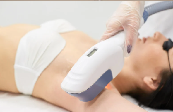 熱破壊式医療脱毛のメリット・デメリット